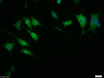 Phospho-Cyclin D1 (Thr286) Rab