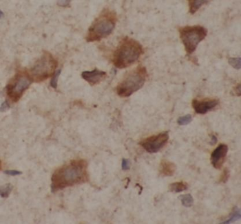 TUBB3 Antibody抗体,orb632967,bio