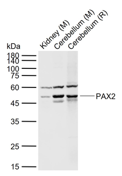 PAX2 Rabbit Polyclonal Antibod