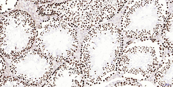 Phospho-H2AX (Ser139) Recombin