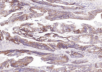 CDKN3 Rabbit Polyclonal Antibo