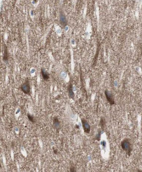 CRY2 Antibody抗体，orb394926，bior