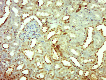 Phospho-Mcl1 (Ser159 + Thr163)