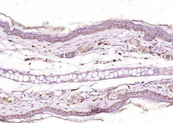 NR2C2 Rabbit Polyclonal Antibo