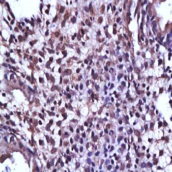 Thioester-containing protein 1