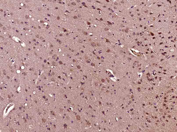 CCNG2 Rabbit Polyclonal Antibo