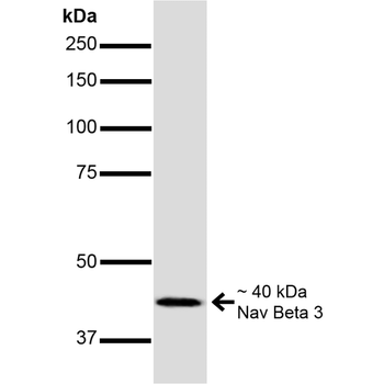 NaVbeta3 Antibody (APC)抗体,orb3