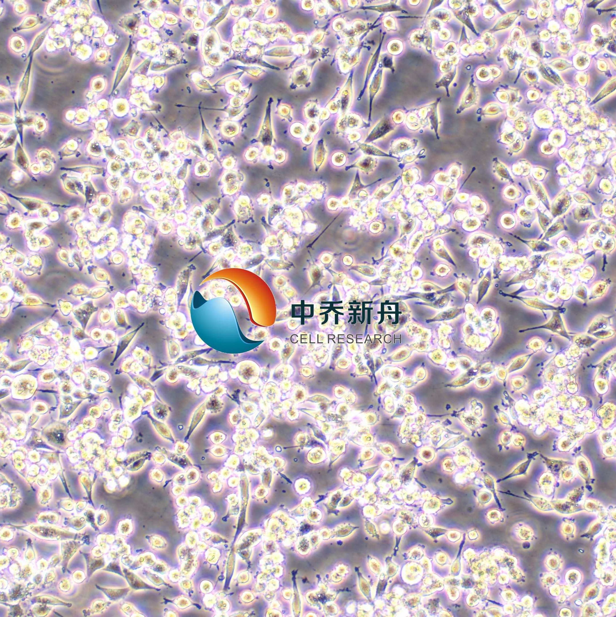 MC38-OVA-LUC小鼠结肠癌细胞转染表达OVA-荧光素酶标记