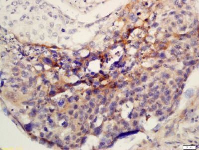Phospho-MEK1/2 (Ser218 + Ser22