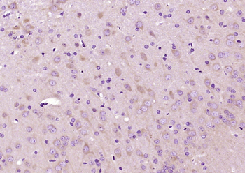GSK-3 Beta Mouse Monoclonal An