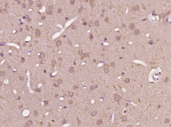 TUBA1C Rabbit Polyclonal Antib