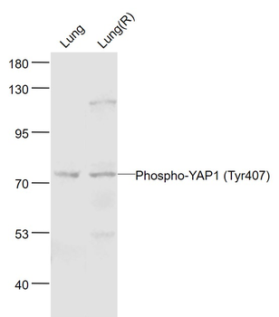 Phospho-YAP1 (Tyr407) Rabbit P