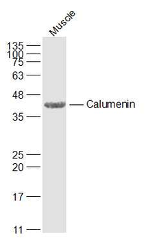 CALU Rabbit Polyclonal Antibod