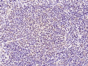 Phospho-PRKCB (Thr642) Rabbit 