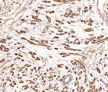 Alpha smooth muscle Actin Reco