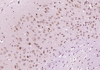 DIO2 Rabbit Polyclonal Antibod