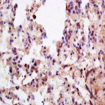 Menin Rabbit Polyclonal Antibo