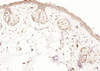 Phospho-BRCA1 (Ser1189) Rabbit