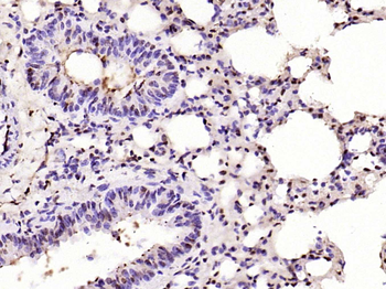 Phospho-CDKN1A/p21 (Thr57) Rab