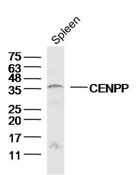 CENPP Rabbit Polyclonal Antibo