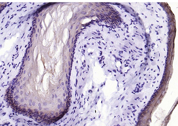 Cytokeratin 4 Recombinant Rabb