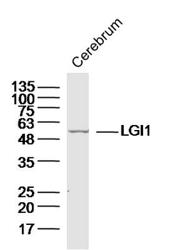 LGI1 Rabbit Polyclonal Antibod