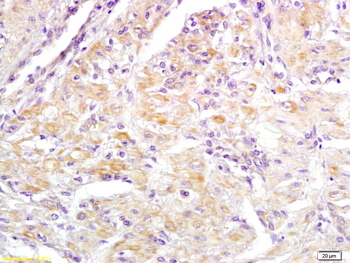 DFFA Rabbit Polyclonal Antibod