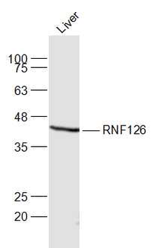 RNF126 Rabbit Polyclonal Antib