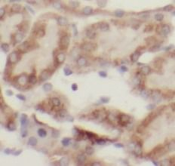 ACSM3 Antibody抗体,orb624467,bio