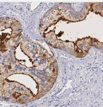 CALN1 Antibody抗体,orb625378,bio