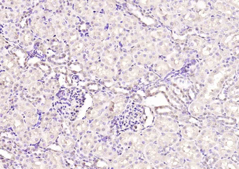 TBLR1 Rabbit Polyclonal Antibo