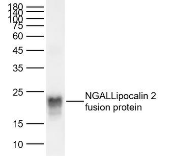 NGAL/Lipocalin 2 Rabbit Polycl