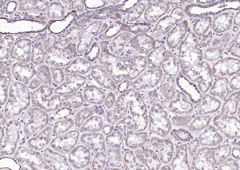 Phospho-Bad (Ser134) Rabbit Po