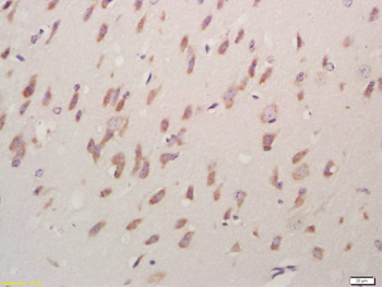 ACCN1 Rabbit Polyclonal Antibo