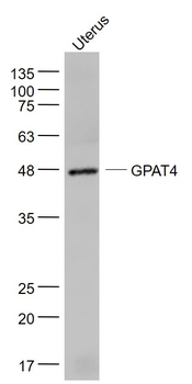 GPAT4 Rabbit Polyclonal Antibo