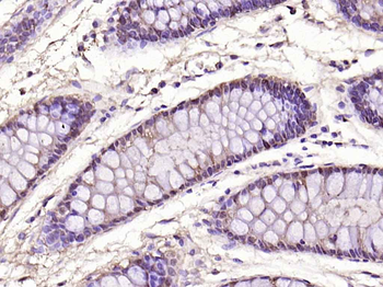 Galectin 3 Mouse Monoclonal An