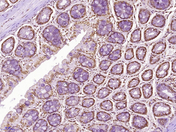 CLK2 Rabbit Polyclonal Antibod