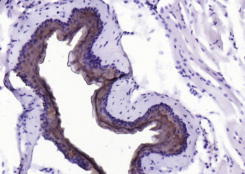 Cytokeratin 4 Recombinant Rabb