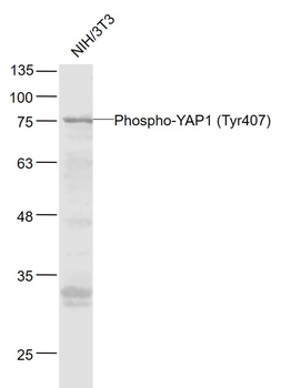 Phospho-YAP1 (Tyr407) Rabbit P