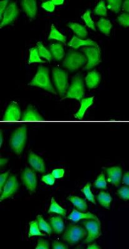GALE Antibody抗体，orb627207，bior