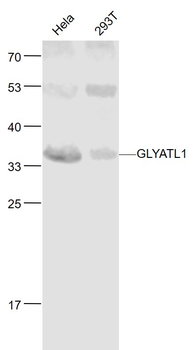 GLYATL1 Rabbit Polyclonal Anti