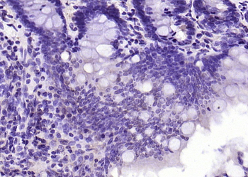 DFFB Rabbit Polyclonal Antibod