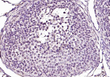 Mst2 Rabbit Polyclonal Antibod