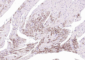 SGPL1 Rabbit Polyclonal Antibo