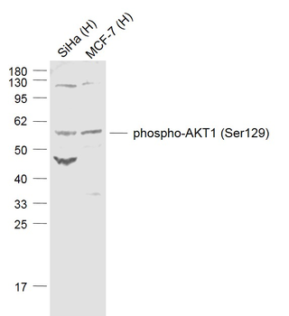 Phospho-AKT1 (Ser129) Rabbit P