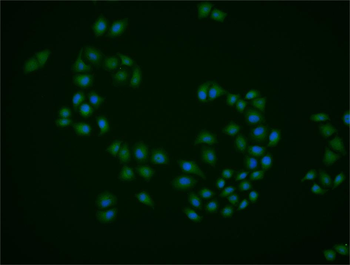 ID2 Rabbit Polyclonal Antibody