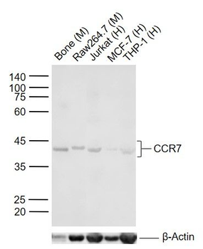 CCR7 Rabbit Polyclonal Antibod