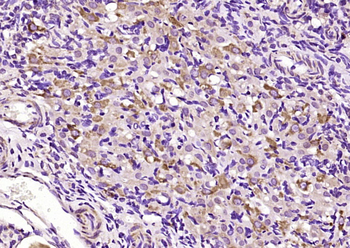 TCAB1 Rabbit Polyclonal Antibo