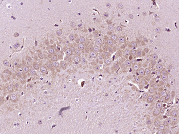 ID2 Rabbit Polyclonal Antibody