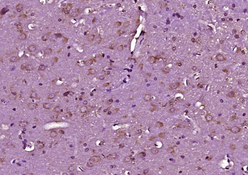 LGI1 Rabbit Polyclonal Antibod